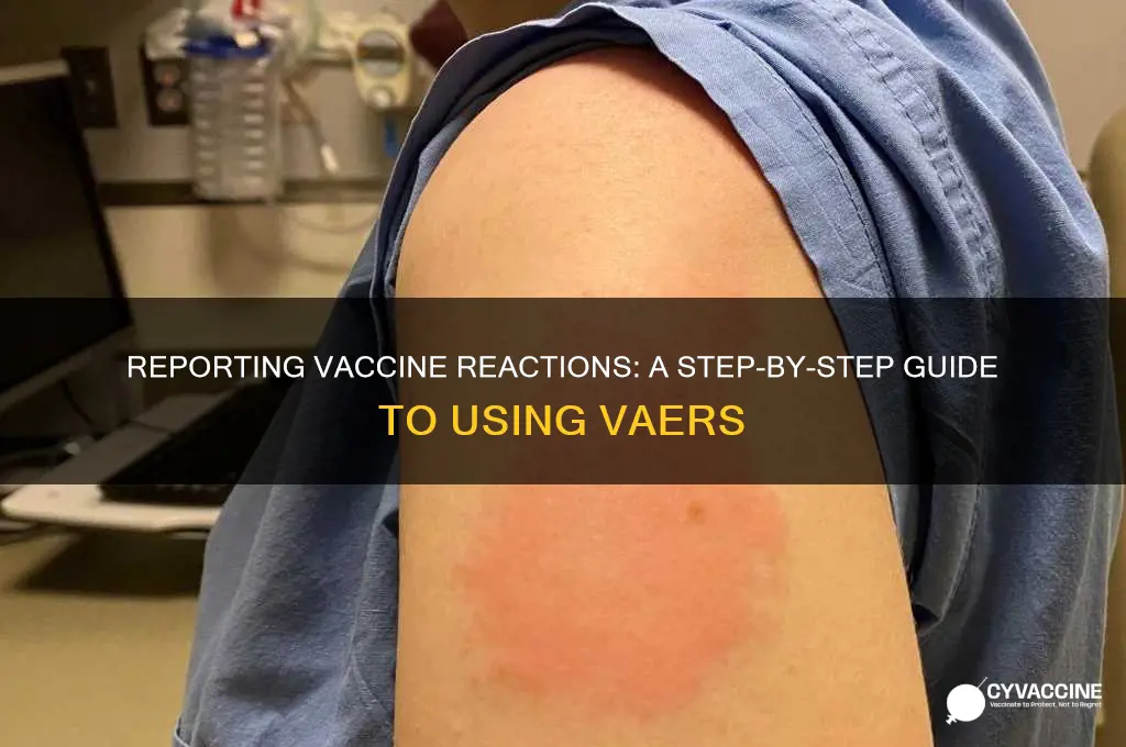 how to report a vaccine reqction to vaers
