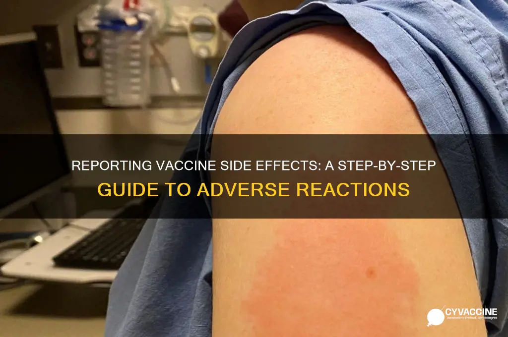 how to report an adverse reaction to a vaccine