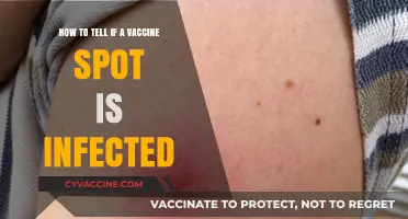 Identifying Infected Vaccine Sites: Symptoms, Risks, and When to Seek Help