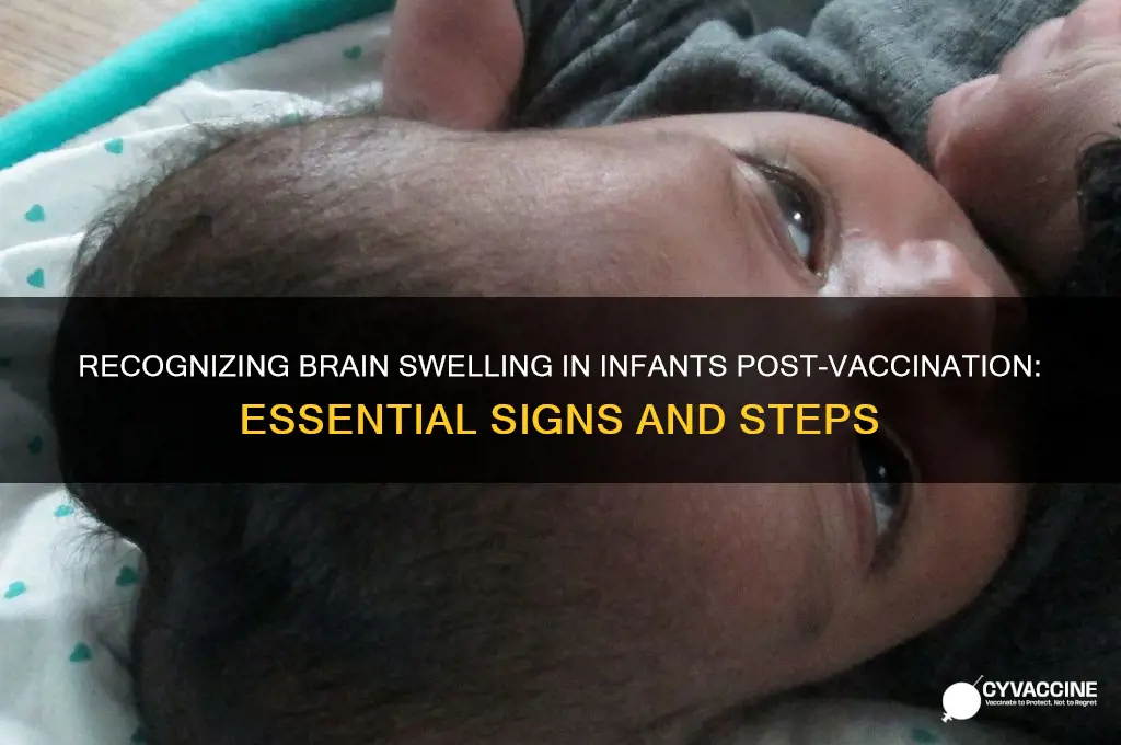how to tell if baby has brain swelling after vaccine