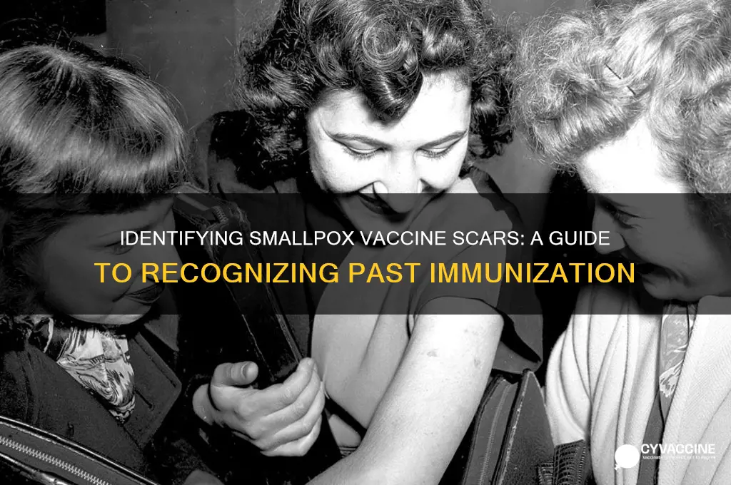 how to tell if you had smallpox vaccine