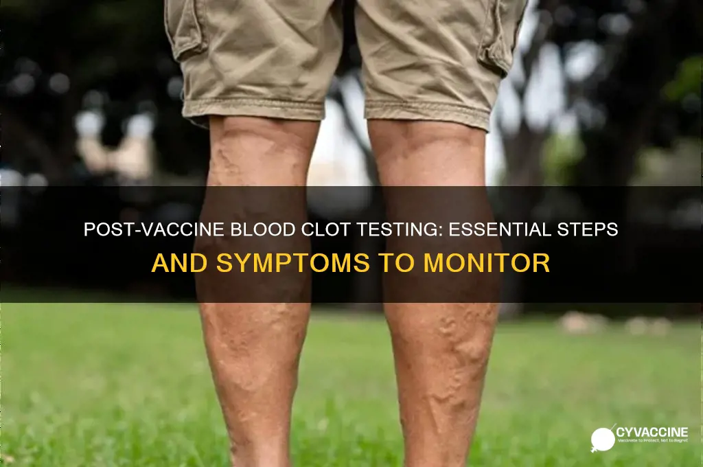 how to test for blood clots after vaccine