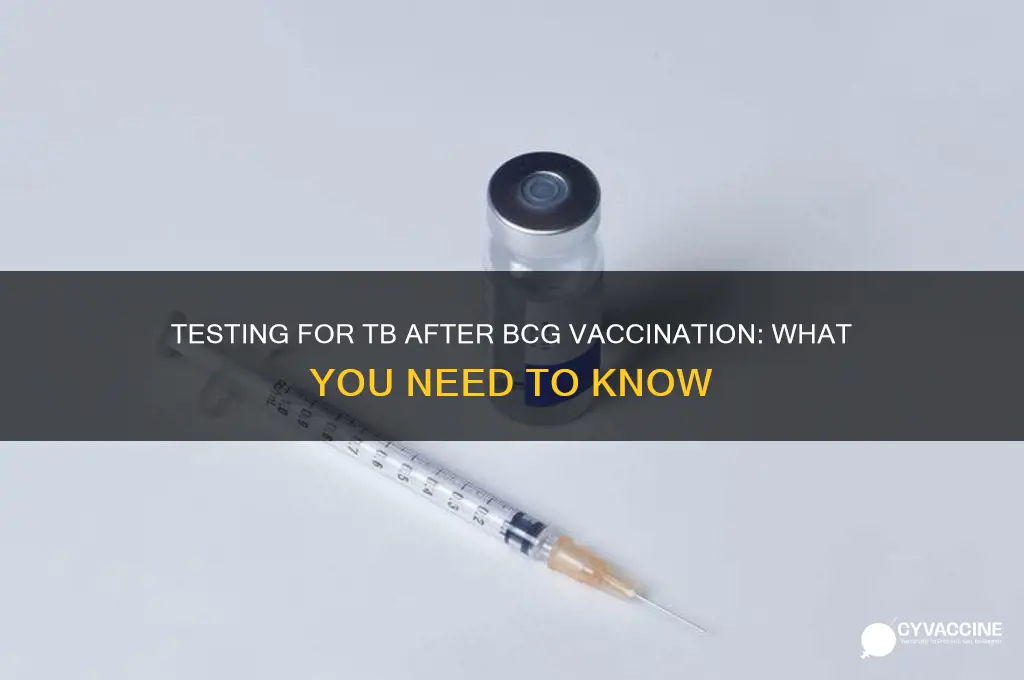 how to test for tb if had bcg vaccination