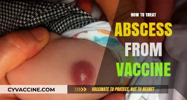 Treating Vaccine-Related Abscesses: A Comprehensive Guide