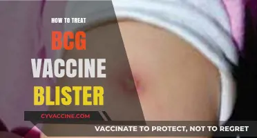 Treating BCG Vaccine Blisters: A Comprehensive Guide for Parents