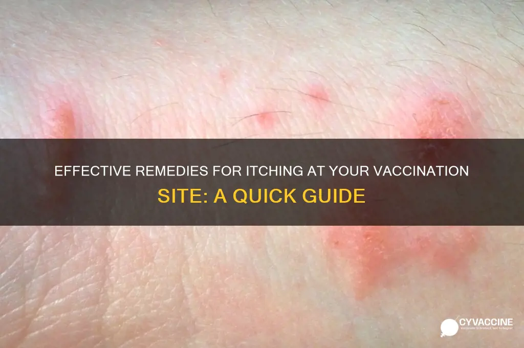 how to treat itching at a vaccination site