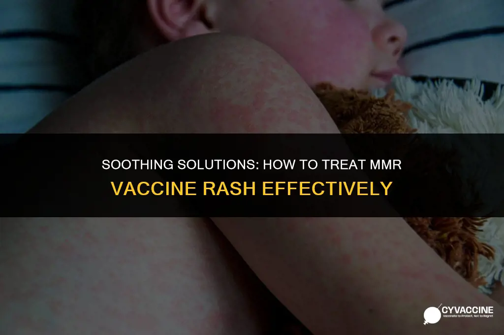 how to treat mmr vaccine rash