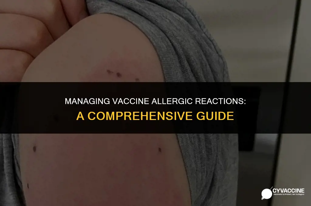how to treat vaccine alergic reaction