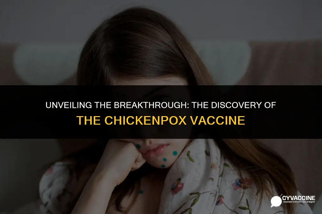 how was chicken pox vaccine discovered