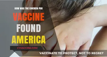 Discovery of the Chicken Pox Vaccine in America: A Breakthrough