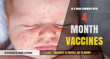 Rash After 4-Month Vaccines: Common Concerns and What to Expect
