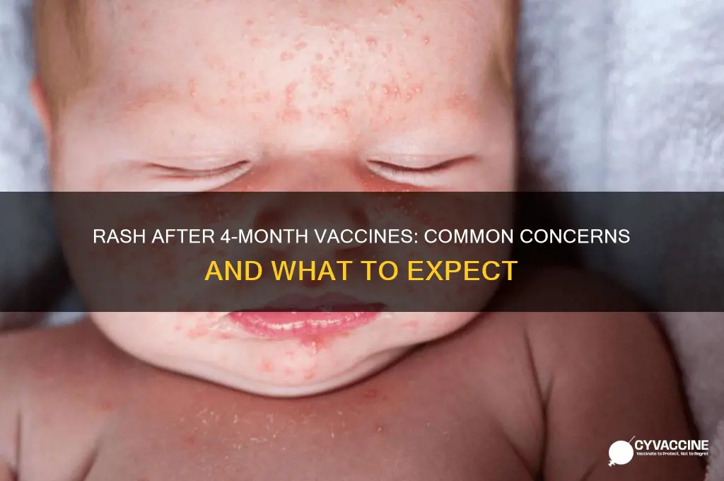 is a rash common with 4 month vaccines