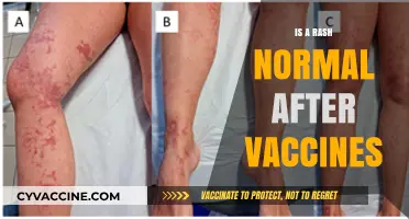 Understanding Vaccine Side Effects: Is a Rash Normal?