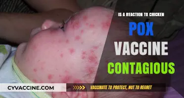 Can Chickenpox Vaccine Reactions Spread? Understanding Contagious Concerns