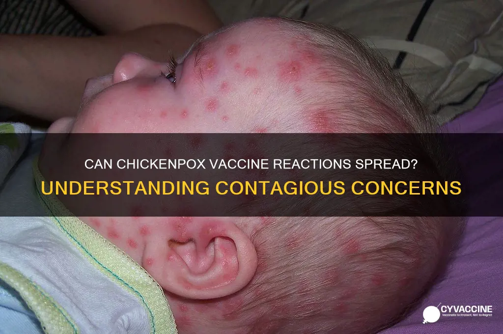 is a reaction to chicken pox vaccine contagious