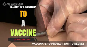 TB Test Allergy vs. Vaccine Reaction: Understanding the Difference