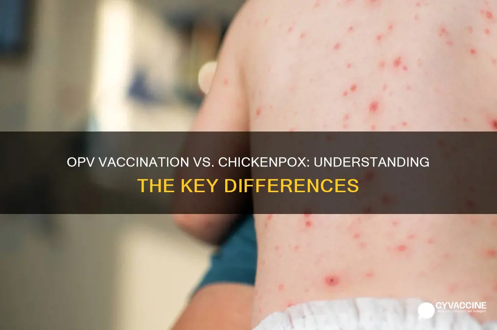 is an opv vaccination the same as chicken pox