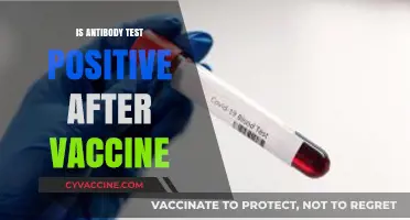 Post-Vaccine Antibody Test: What a Positive Result Means
