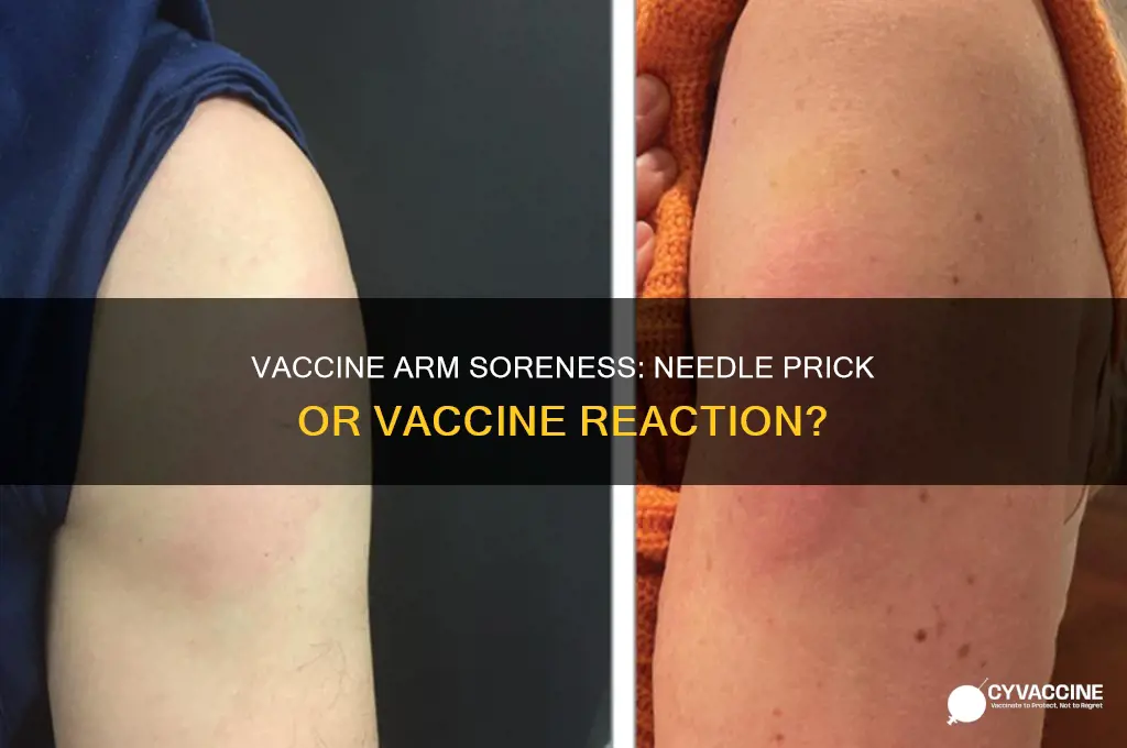 is arm soreness from the needle or the vaccine