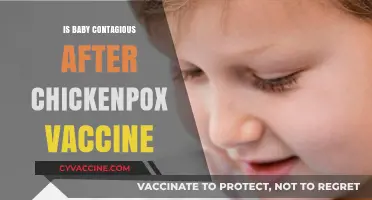 Understanding Chickenpox Vaccine Contagion: Is Your Baby at Risk?