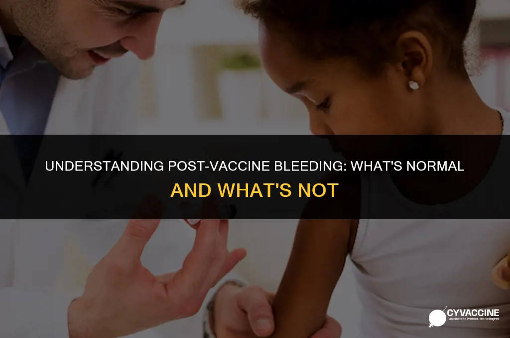 is bleeding after a vaccine normal