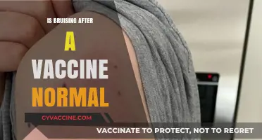 Understanding Bruising After Vaccination: What's Normal and What's Not