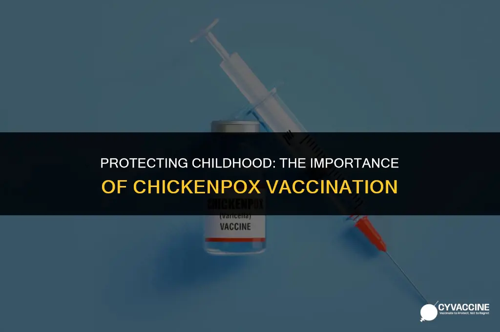 is chicken pox a childhood vaccine