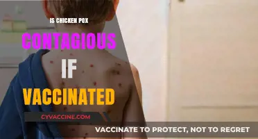 Vaccinated Against Chickenpox: Are You Still Contagious?