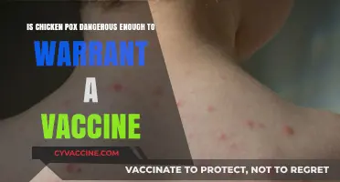 Chicken Pox Vaccine: Necessary Precaution or Overkill for a Common Illness?