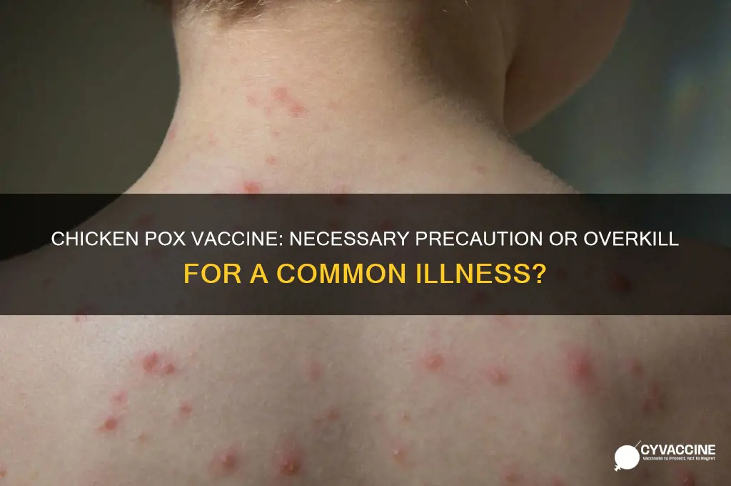 is chicken pox dangerous enough to warrant a vaccine