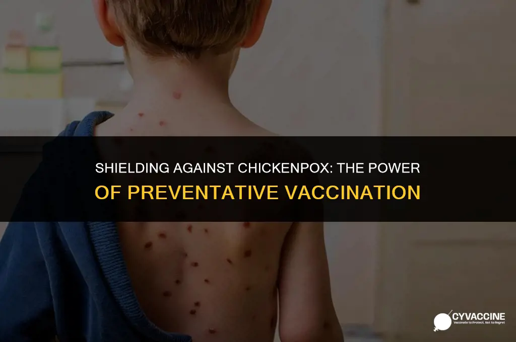 is chickenpox vaccine a preventative care