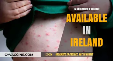 Exploring Chickenpox Vaccine Availability in Ireland: Facts and Insights