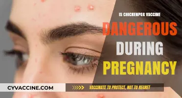 Exploring the Safety of Chickenpox Vaccination During Pregnancy