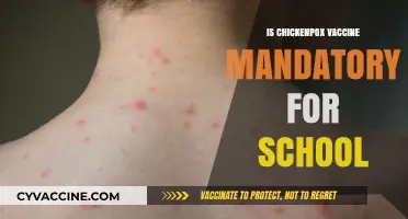 Exploring the Necessity of Chickenpox Vaccination for School Entry