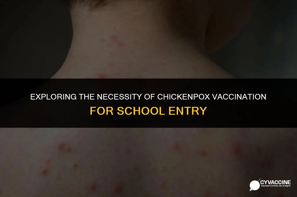 is chickenpox vaccine mandatory for school