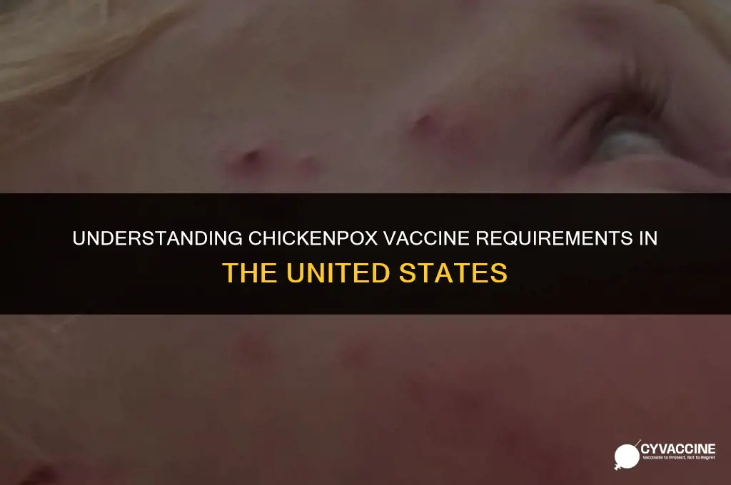 is chickenpox vaccine mandatory in us