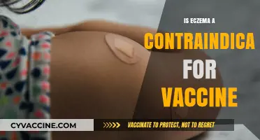 Exploring Eczema: Is It a Contraindication for Vaccines?