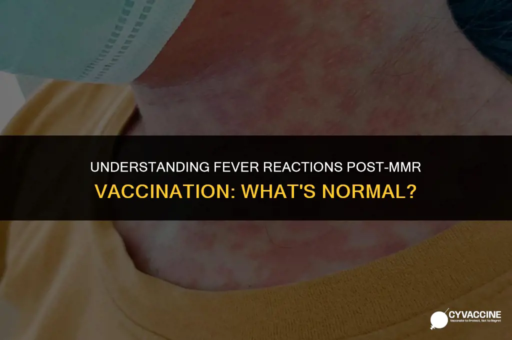 is fever common after mmr vaccine