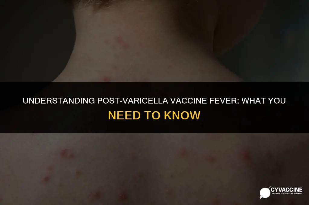 is fever common after varicella vaccine