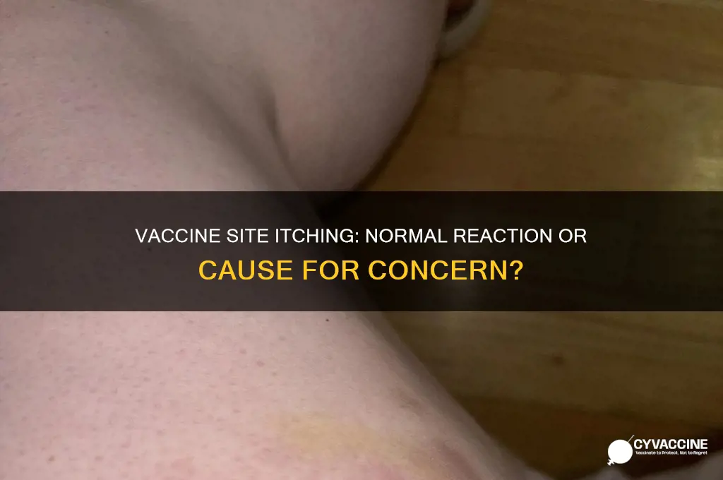 is it bad if a vaccine site icches