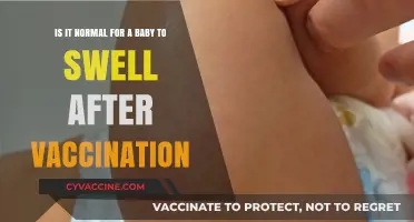 Baby Swelling After Vaccination: What's Normal and When to Worry