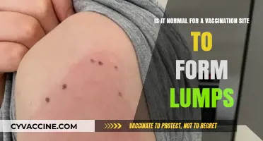 Vaccination Site Lumps: Common Reactions or Cause for Concern?
