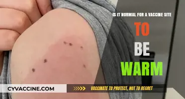 Is a Warm Vaccine Site Normal? Understanding Post-Vaccination Symptoms
