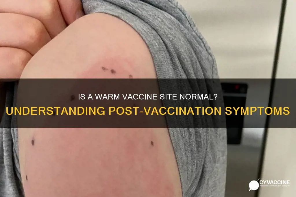 is it normal for a vaccine site to be warm