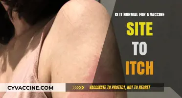 Is It Normal for a Vaccine Site to Itch? Understanding Post-Vaccination Reactions