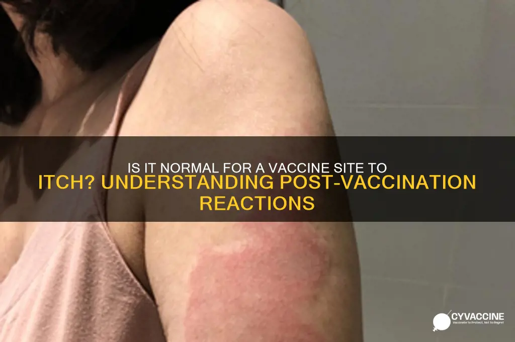 is it normal for a vaccine site to itch