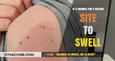 Vaccine Site Swelling: Understanding Normal Reactions and When to Worry