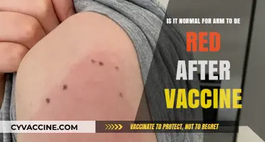 Is Arm Redness Normal After Vaccination? Understanding Post-Shot Reactions