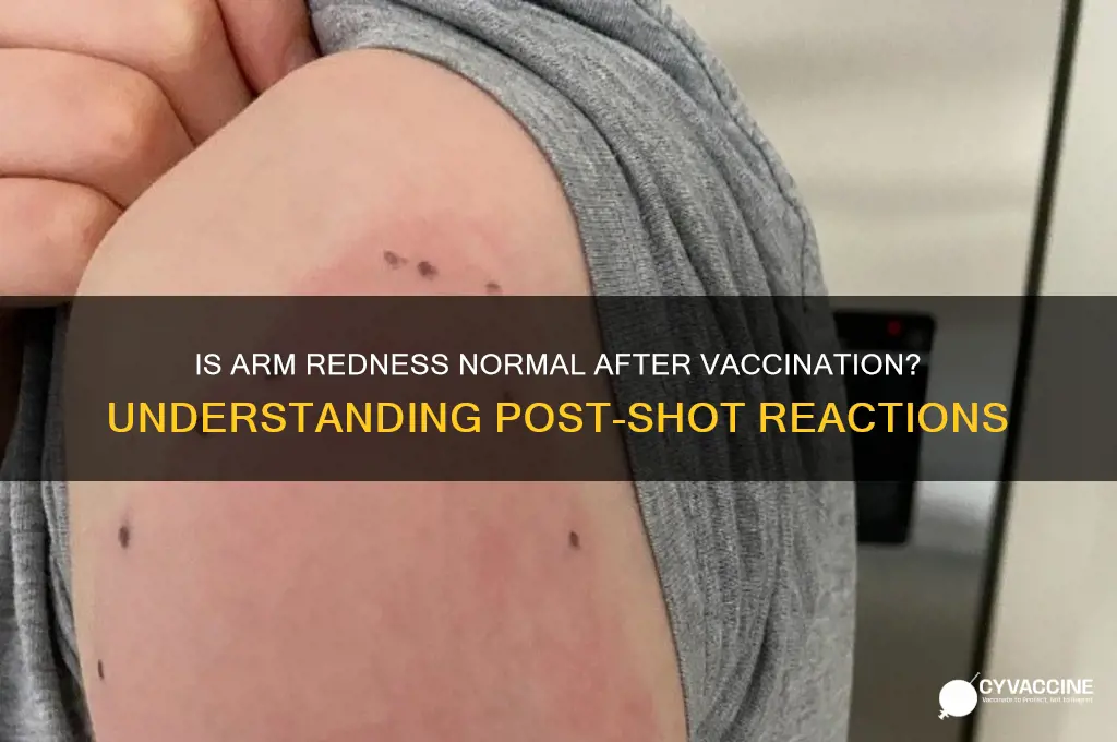 is it normal for arm to be red after vaccine