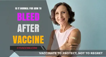 Is Arm Bleeding After a Vaccine Normal? What You Need to Know